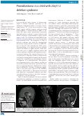 Cover page: Pineoblastoma in a child with 22q11.2 deletion syndrome