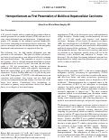 Cover page: Hemoperitoneum as First Presentation of Multifocal Hepatocellular Carcinoma