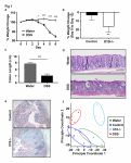 Cover page: Identification of novel mRNAs and lncRNAs associated with mouse experimental colitis and human inflammatory bowel disease