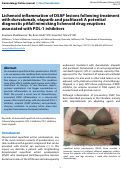 Cover page: Lichenoid inflammation of DSAP lesions following treatment with durvalumab, olaparib and paclitaxel: A potential diagnostic pitfall mimicking lichenoid drug eruptions associated with PDL-1 inhibitors