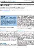 Cover page: Spontaneous resolution of exuberant localized sporotrichosis after childbirth