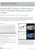 Cover page: Incidental PET/CT Detection of Breast Cancer in a Patient with Negative Mammogram and Breast Sonogram