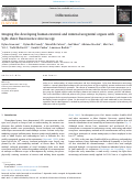 Cover page: Imaging the developing human external and internal urogenital organs with light sheet fluorescence microscopy.