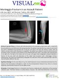 Cover page: Monteggia Fracture in an Assault Patient