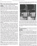 Cover page: Diabetics show accelerated progression of cartilage and meniscal lesions: data from the osteoarthritis initiative