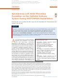 Cover page: Spontaneous Left Atrial Thrombus Formation on the Catheter Delivery System During WATCHMAN Implantation