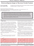 Cover page: Electrocardiogram changes in thyrotoxic periodic paralysis