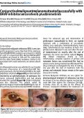 Cover page: Conjunctival malignant melanoma treated successfully with BRAF inhibitor: encorafenib plus binimetinib