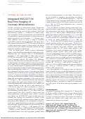 Cover page: Integrated intracoronary optical coherence tomography-ultrasound for in vivo real-time imaging of atherosclerotic plaques