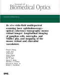 Cover page: In vivo wide-field multispectral scanning laser ophthalmoscopy–optical coherence tomography mouse retinal imager: longitudinal imaging of ganglion cells, microglia, and Müller glia, and mapping of the mouse retinal and choroidal vasculature