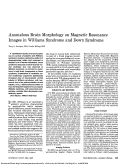 Cover page: Anomalous Brain Morphology on Magnetic Resonance Images in Williams Syndrome and Down Syndrome