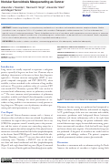 Cover page: Nodular Sarcoidosis Masquerading as Cancer