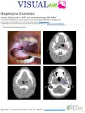 Cover page: Oropharynx Ulceration