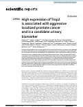 Cover page: High expression of Trop2 is associated with aggressive localized prostate cancer and is a candidate urinary biomarker.