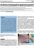 Cover page: The dilemma of treating pyoderma gangrenosum associated with monoclonal gammopathy of undetermined significance