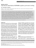 Cover page: The histone demethylase KDM4B regulates peritoneal seeding of ovarian cancer