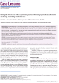 Cover page: Retrograde thrombosis of the superficial sylvian vein following liquid adhesive hemostat use during craniotomy: illustrative case.