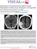 Cover page: Spontaneous Intracranial Hemorrhage in Severe Hemophilia A: A Rare Cause of Seizure in a Young Child