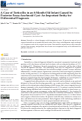 Cover page: A Case of Torticollis in an 8-Month-Old Infant Caused by Posterior Fossa Arachnoid Cyst: An Important Entity for Differential Diagnosis