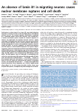 Cover page: An absence of lamin B1 in migrating neurons causes nuclear membrane ruptures and cell death.