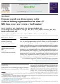 Cover page: Pressure control cam displacement in the Codman-Hakim programmable valve after a 3T MRI: Case report and review of the literature.