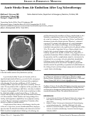 Cover page: Acute Stroke from Air Embolism After Leg Sclerotherapy