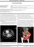 Cover page: Aortocaval Fistula