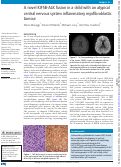 Cover page: A novel KIF5B-ALK fusion in a child with an atypical central nervous system inflammatory myofibroblastic tumour