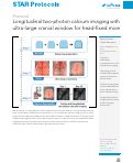 Cover page: Longitudinal two-photon calcium imaging with ultra-large cranial window for head-fixed mice