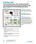 Cover page: Transcriptional space-time mapping identifies concerted immune and stromal cell patterns and gene programs in wound healing and cancer