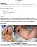 Cover page: “Blueberry muffin” rash and large right thigh mass: a unique presentation of Langerhans cell histiocytosis