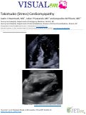 Cover page: Takotsubo (Stress) Cardiomyopathy