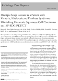 Cover page: Multiple Scalp Lesions in a Patient with Keratitis, Ichthyosis and Deafness Syndrome Mimicking Metastatic Squamous Cell Carcinoma on 18F-FDG PET/CT