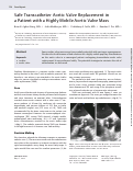 Cover page: Safe Transcatheter Aortic Valve Replacement in a Patient with a Highly Mobile Aortic Valve Mass