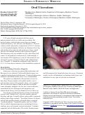 Cover page: Oral Ulcerations