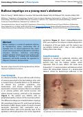 Cover page: Bullous impetigo on a young man's abdomen