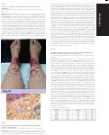 Cover page: Su1004 Using Search Engine Query Data to Explore Epidemiology of Common Gastrointestinal Symptoms