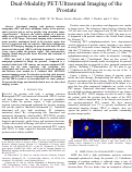 Cover page: Dual-Modality PET/Ultrasound imaging of the Prostate