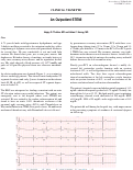 Cover page: An Outpatient STEMI