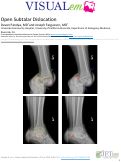 Cover page: Open Subtalar Dislocation