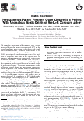 Cover page: Percutaneous Patent Foramen Ovale Closure in a Patient With Anomalous Aortic Origin of the Left Coronary Artery