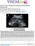 Cover page: Point of Care Ultrasound Illustrating Small Bowel Obstruction