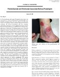 Cover page: Pembrolizumab and Enfortumab Associated Bullous Pemphigoid