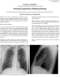 Cover page: Pulmonary Complications of Marijuana Smoking