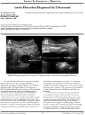 Cover page: Aortic Dissection Diagnosed by Ultrasound