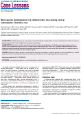 Cover page: Microvascular decompression of a vertebral artery loop causing cervical radiculopathy: illustrative case.