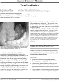 Cover page: Torus Mandibularis