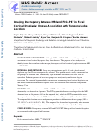 Cover page: Focal cortical dysplasia imaging discrepancies between MRI and FDG-PET: Unique association with temporal lobe location