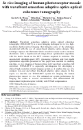 Cover page: In vivo imaging of human photoreceptor mosaic with wavefront sensorless adaptive optics optical coherence tomography