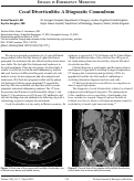 Cover page: Cecal Diverticulitis: A Diagnostic Conundrum